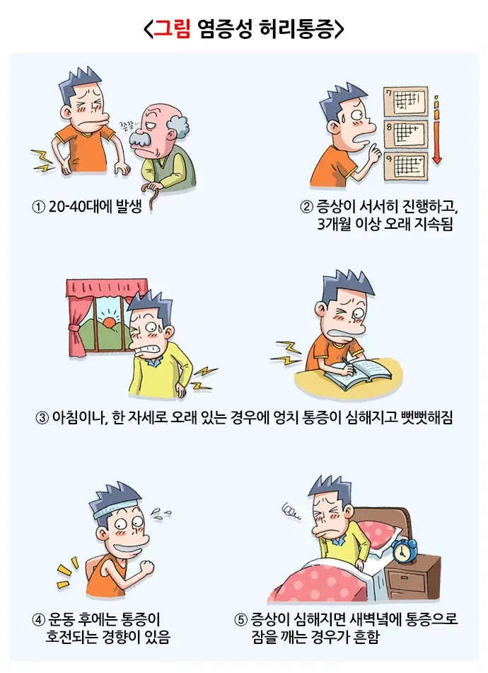 강직척추염 증상 설명 이미지 1