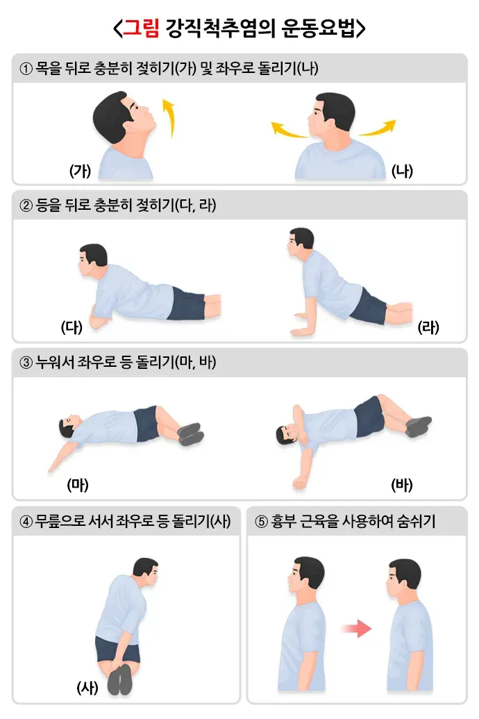 강직척추염 비약물 치료 설명 이미지 1