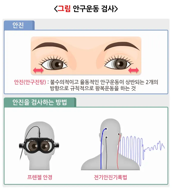 어지럼 진단 및 검사 설명 이미지 1