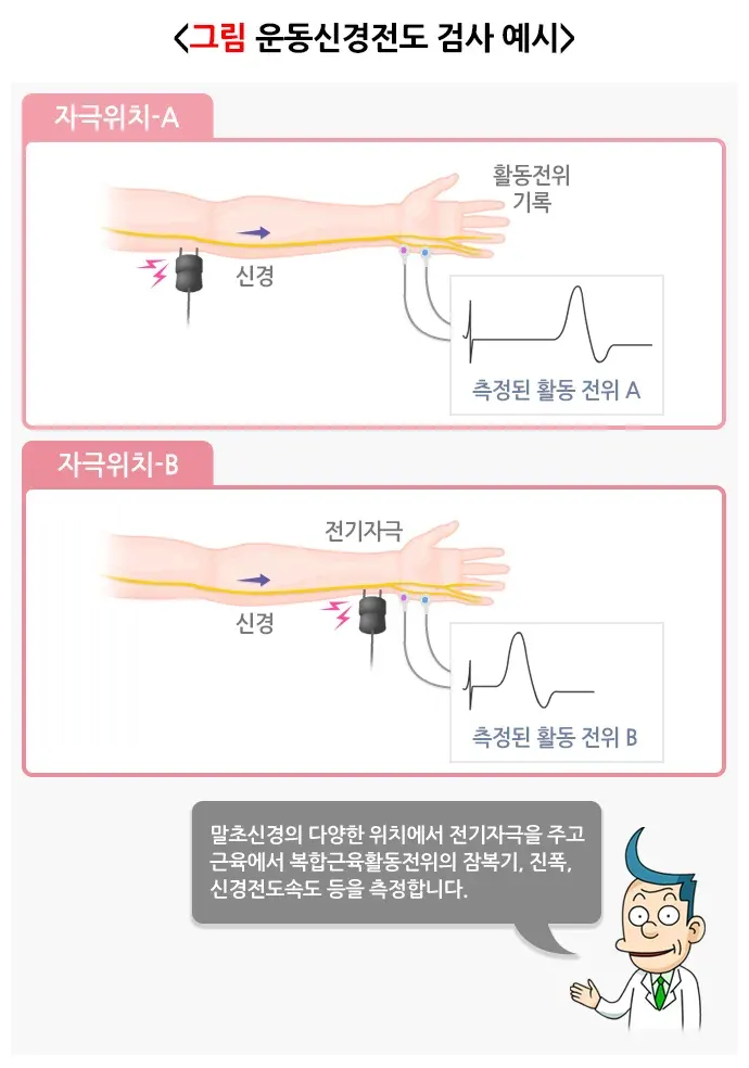 근전도 신경전도검사 검사 결과 해석 설명 이미지 1
