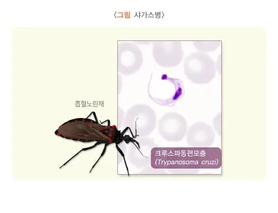 샤가스병 원인 및 감염경로 설명 이미지 1