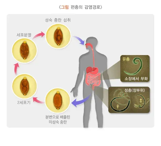 편충증 원인 및 감염경로 설명 이미지 1