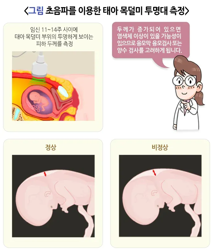 초음파 태아 목덜미 투명대 측정 검사 검체 설명 이미지 1