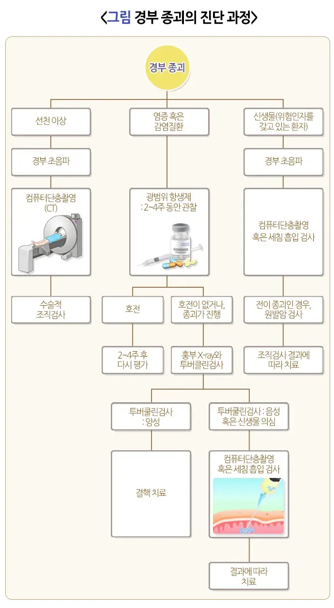 경부 종괴 진단 및 검사 설명 이미지 3