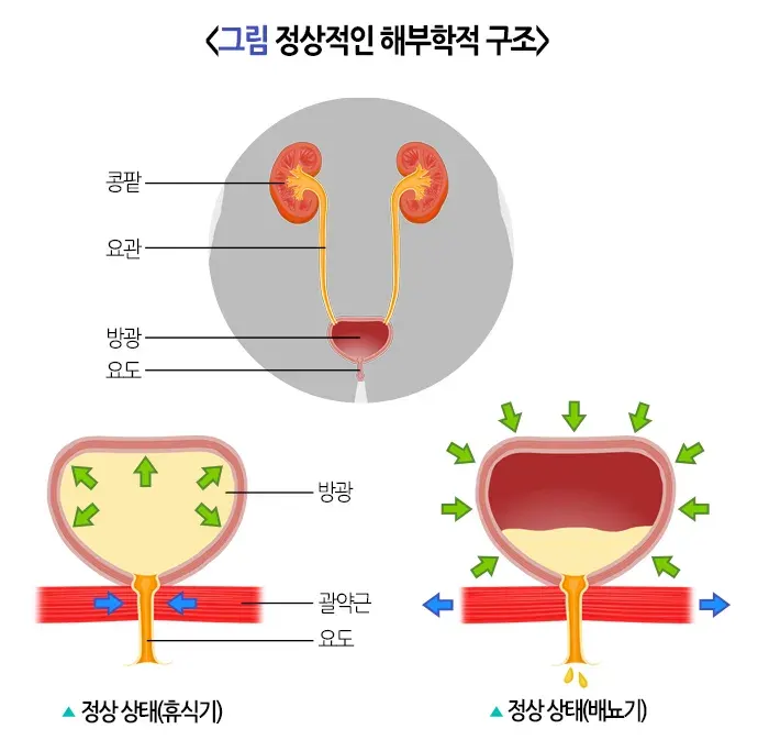 야뇨증(소아) 원인 설명 이미지 1