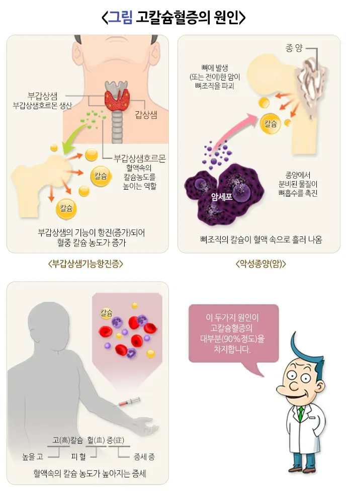 고칼슘혈증 원인 설명 이미지 1