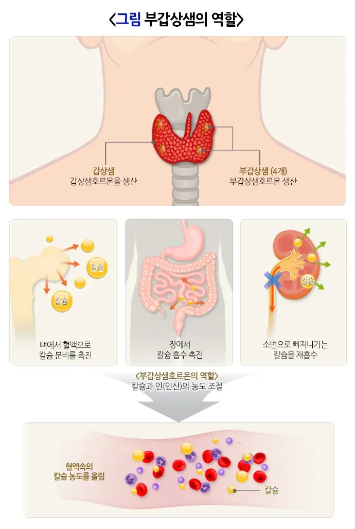 고칼슘혈증 치료 설명 이미지 1