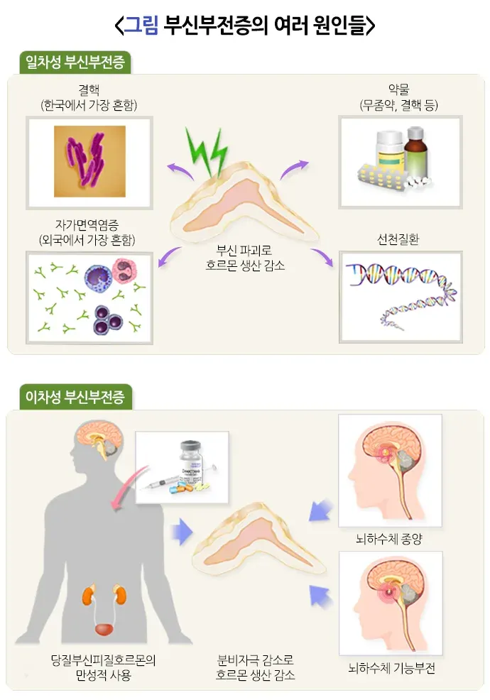 부신부전증 원인 설명 이미지 1