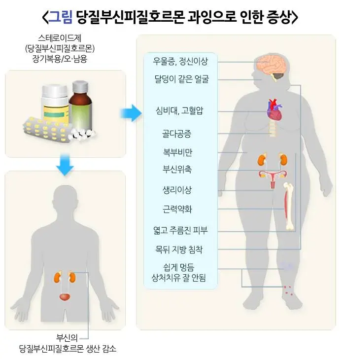부신부전증 증상 설명 이미지 2