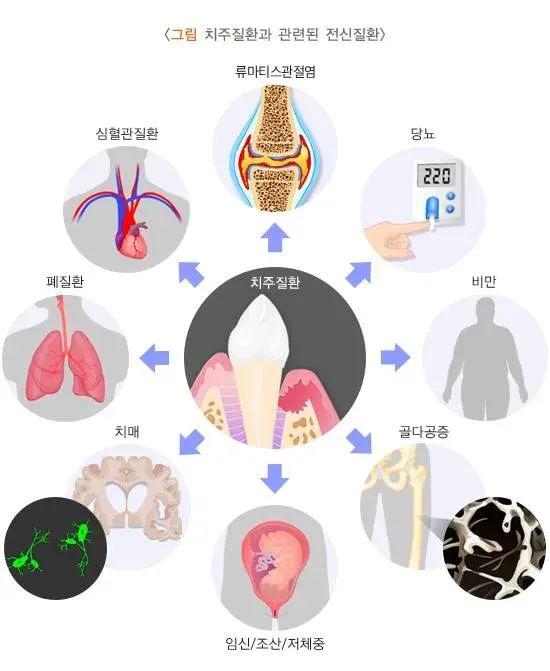 전신질환과 치주치료 관련 질환 설명 이미지 1