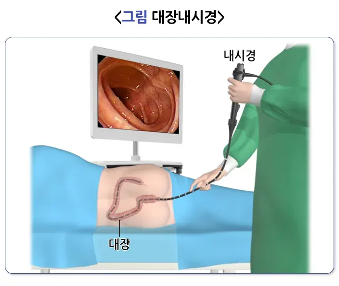 변실금 진단 및 검사 설명 이미지 3