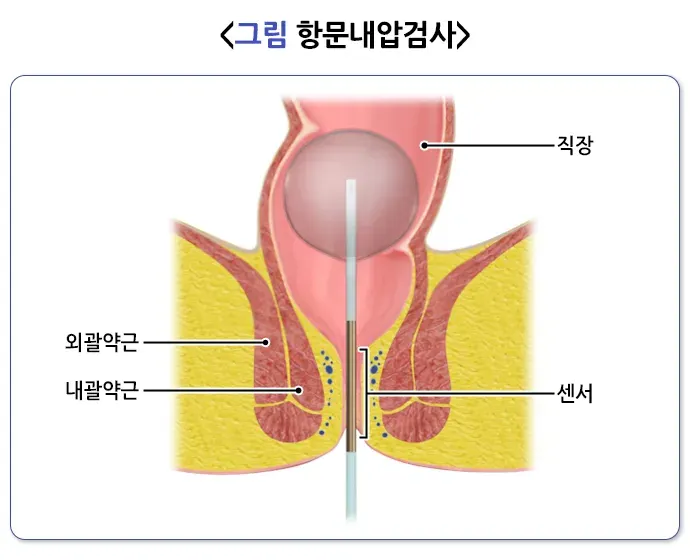 변실금 진단 및 검사 설명 이미지 1