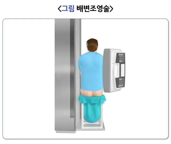 변실금 진단 및 검사 설명 이미지 2