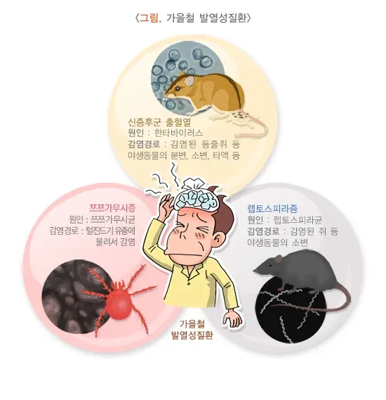 쯔쯔가무시증 진단 및 검사 설명 이미지 1