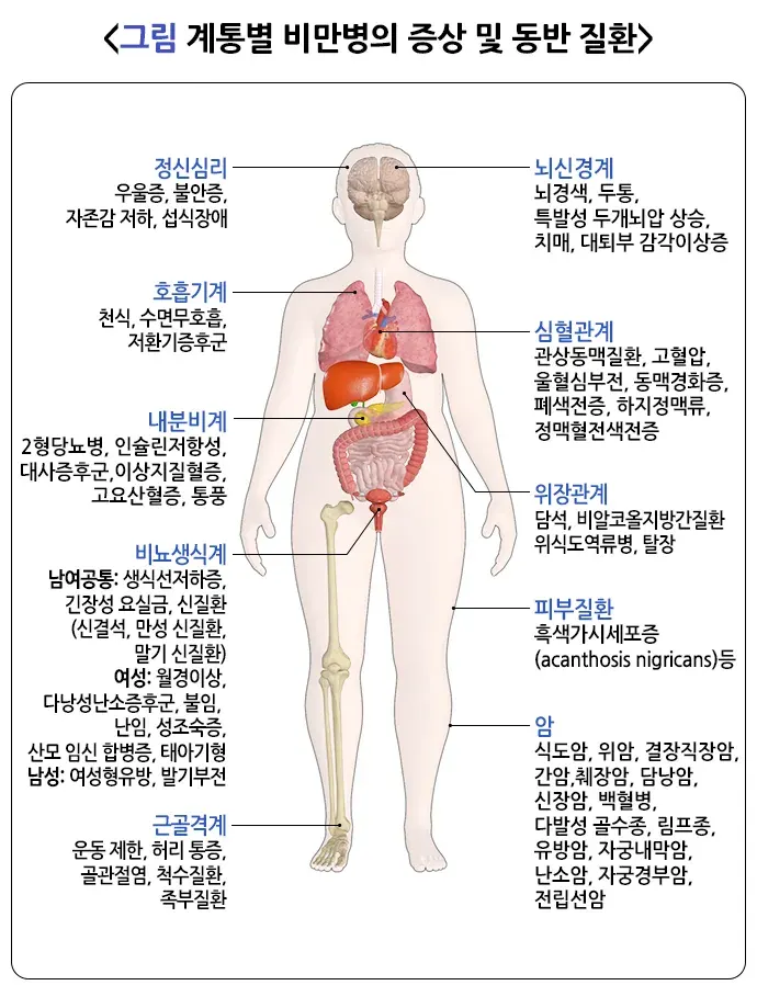 비만 건강에 미치는 영향 설명 이미지 1
