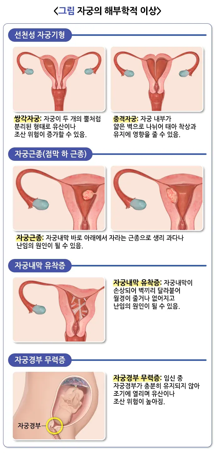 자연유산 원인 설명 이미지 3