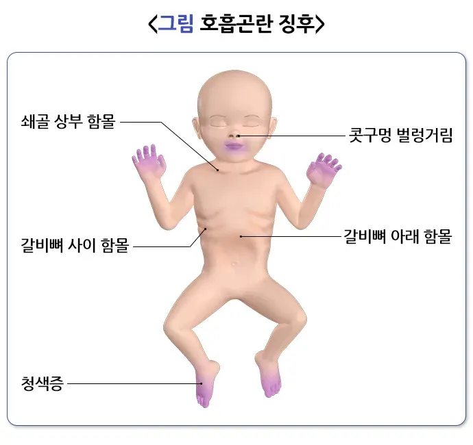 세기관지염 증상 설명 이미지 1