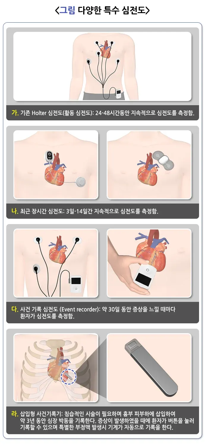심장박동조율기 관련 증상 및 질환 설명 이미지 1