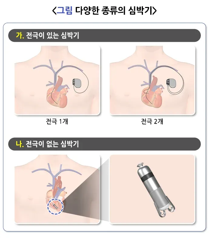 심장박동조율기 도구 관리 설명 이미지 1