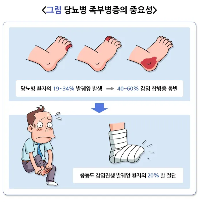 당뇨병성 족부병증 역학 및 통계 설명 이미지 1