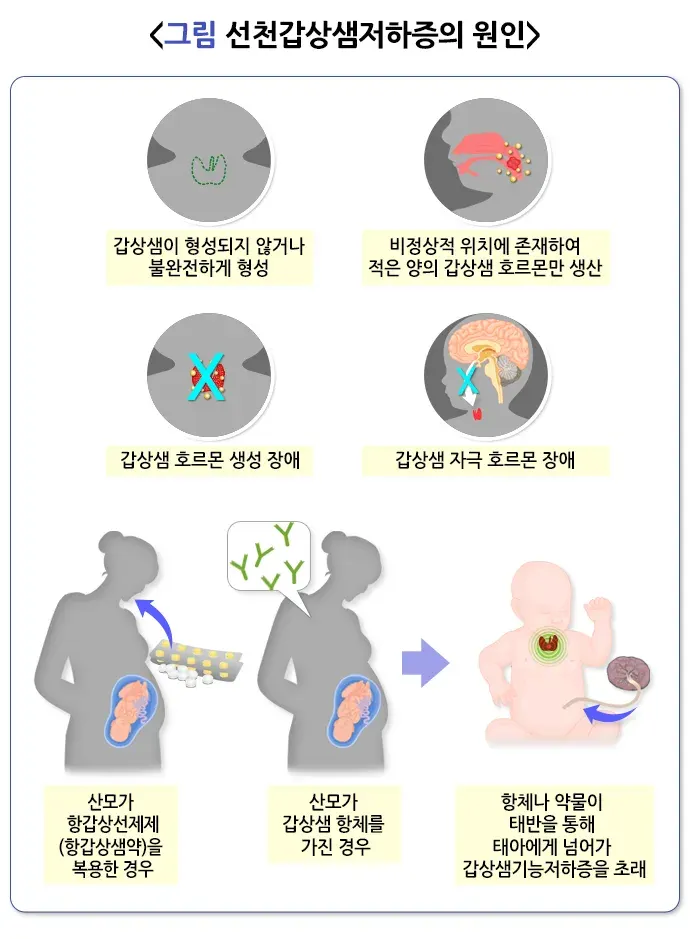 선천갑상샘저하증 원인 설명 이미지 2