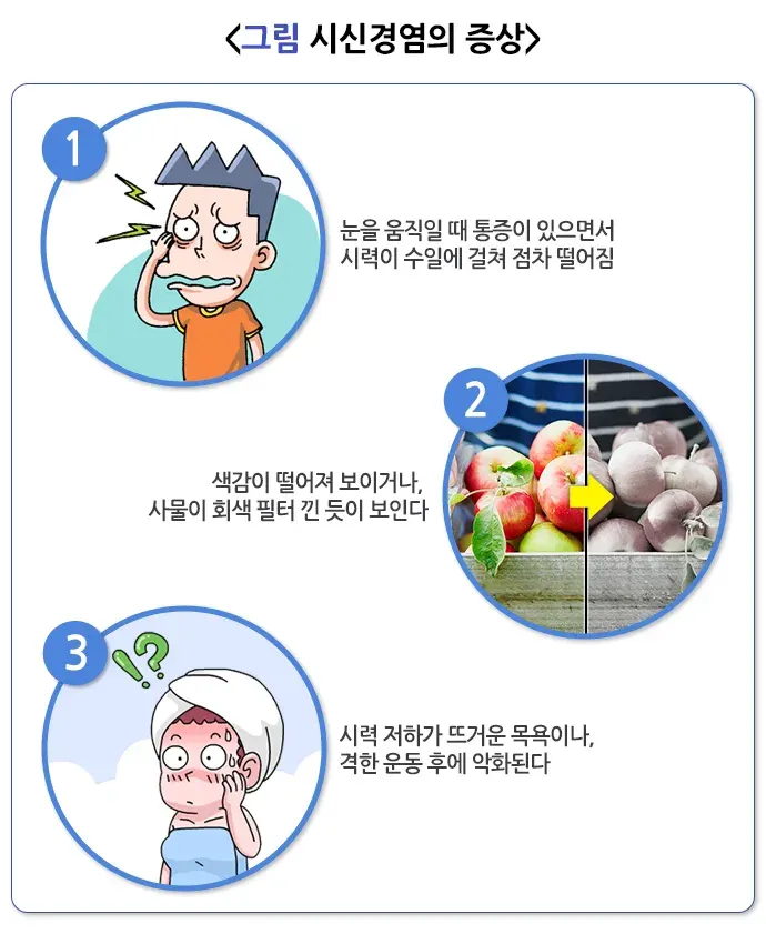 시신경염 증상 설명 이미지 1