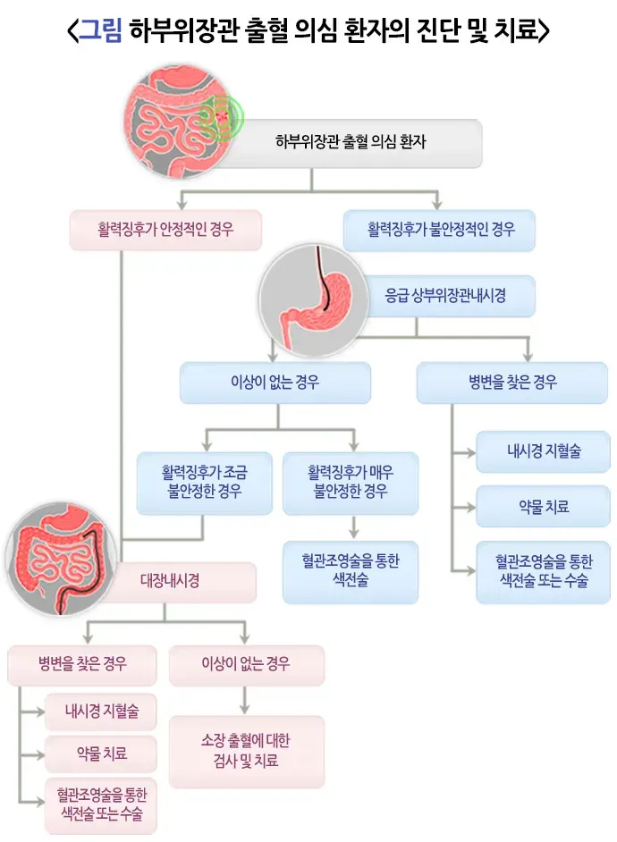 혈변 및 흑변(성인) 치료 설명 이미지 6