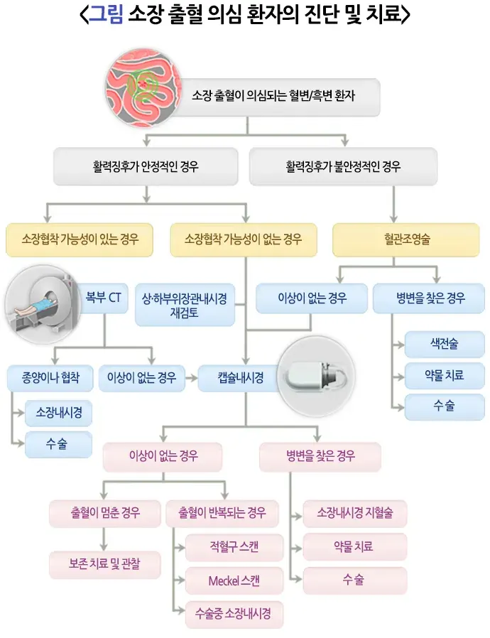 혈변 및 흑변(성인) 치료 설명 이미지 7