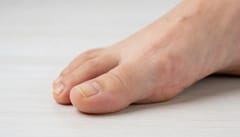 의정부 발톱무좀, 치료 시작 전 검사비와 보험 기준 미리 알아두기
