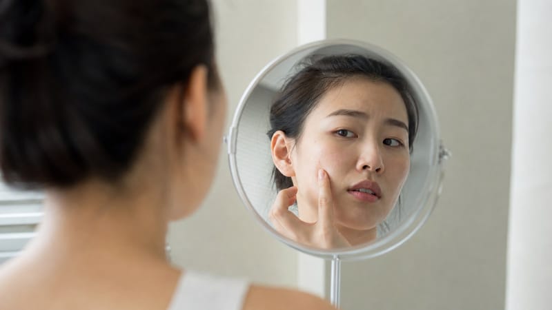 의정부 여드름흉터, 흉터율 47%가 말해주는 치료 타이밍