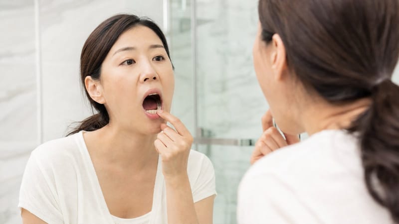 서초·고속터미널 구내염, 연고와 시술 사이의 선택 기준