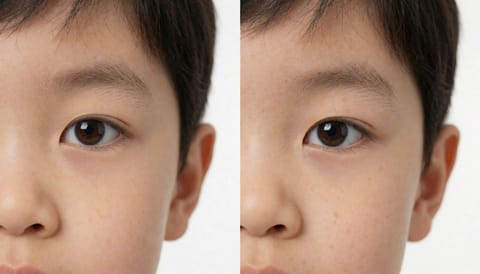 석계역 소아안과, 아이 눈은 나이마다 다르게 살펴야 합니다