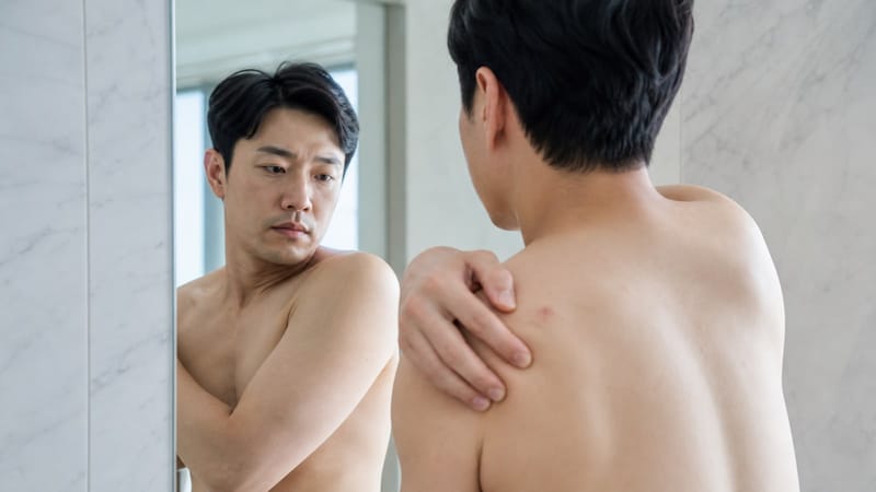 녹양동 피지낭종, 그냥 두면 커질까요 짜도 될까요