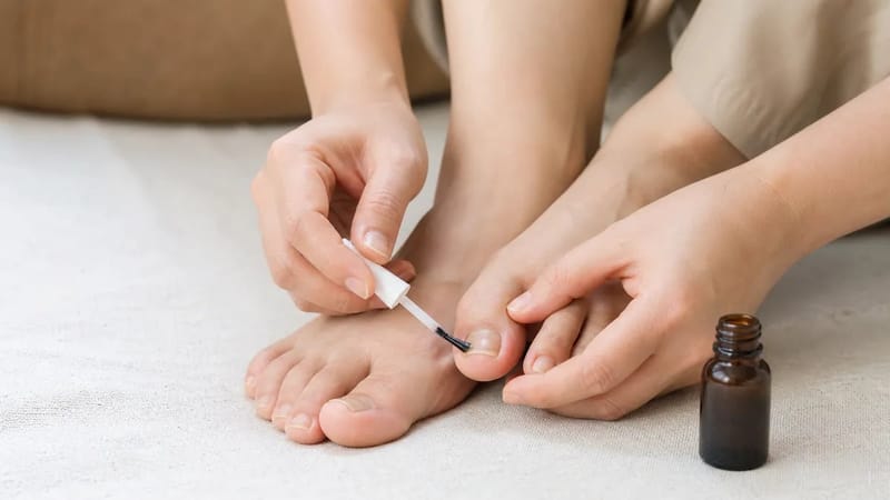 상황에 따라 먹는 약과 바르는 약 중에서 선택하는 치료 과정을 보여줍니다.