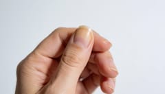 손톱이 누렇게 변하고 두꺼워진다면, 무좀 초기 신호 아닐까