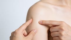 피부밑 물렁한 멍울 만져진다면, 지방종 실비보험 적용 여부 확인해야