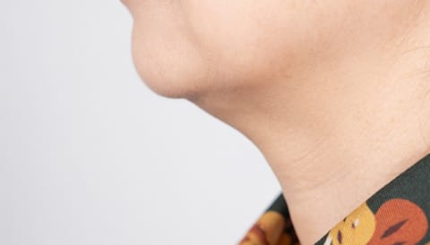 식사 때 턱밑이 붓고 쑤신다면… 가을 건조함 아닌 '침샘결석' 의심
