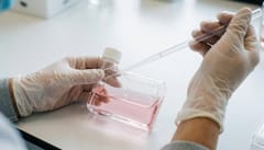 줄기세포 치료 받기까지 2~3년 걸렸다면, 이제 심사 기준 달라진다