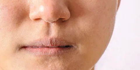 입과 눈이 자주 마른다면 단순 건조증 아닌 전신 질환 신호일 수도