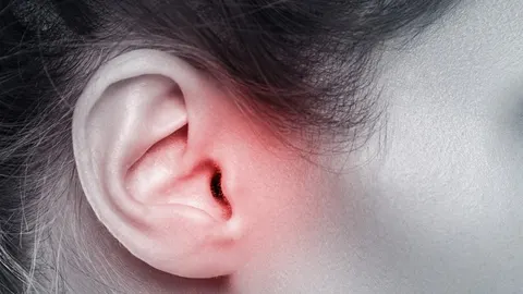 여름휴가 후 귀가 간지럽고 아프다면? 외이도염, 물놀이나 샤워 후 특히 조심해야