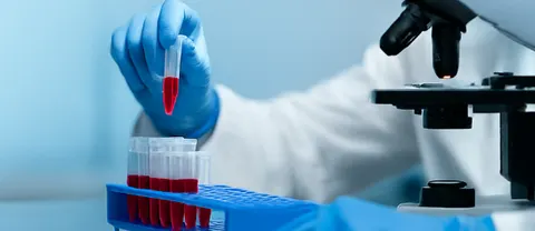 CAR-T 한계 넘는다… 레제네론 ‘오드로넥사타맙’, 혈액암 환자서 종양 70% 소멸