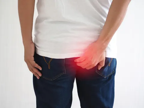 말 못 할 고통, 치질 예방은 조용히 시작돼야 한다