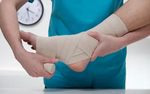 발목 삐끗한 게 전부가 아닙니다 방치하면 평생 후유증 남을 수 있어요