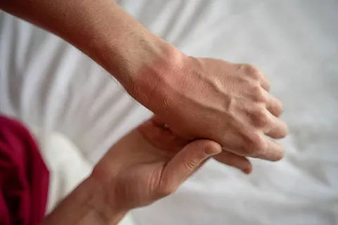 자꾸 손이 붓고 뻣뻣해진다면, 단순 피로가 아닐 수 있어요