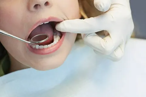 채소가 치아를 닳게 한다? — 식물 속 미세입자, 치아 표면 손상 유발 가능성 밝혀져