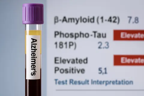 FDA, 알츠하이머 진단용 혈액검사 첫 승인… 르켐비 치료 확대 기로에 서다