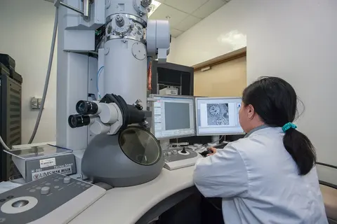 전임상 동물 연구 통해 밝혀진 요산의 뇌졸중 회복 효과